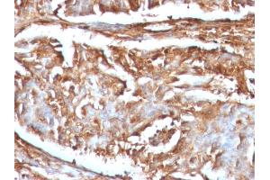 Immunohistochemistry (IHC) image for anti-beta-2-Microglobulin (B2M) antibody (ABIN6940415)