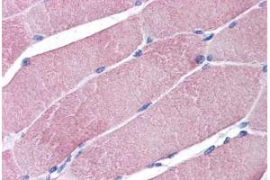 Human Skeletal Muscle: Formalin-Fixed, Paraffin-Embedded (FFPE) (TRIM7 antibody  (AA 209-221))