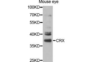 Western blot analysis of extracts of Mouse eye cell line, using CRX antibody.
