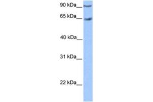 Western Blotting (WB) image for anti-Zinc Finger Protein 449 (ZNF449) antibody (ABIN2460405) (ZNF449 antibody)