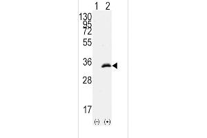 Western blot analysis of CDK1(arrow) using rabbit polyclonal CDK1 Antibody (T14) (ABIN391744 and ABIN2841621). (CDK1 antibody  (AA 1-30))