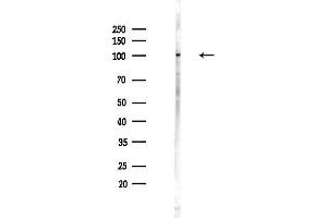 anti-Scaffold Attachment Factor B (SAFB) (C-Term) antibody