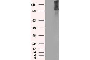 Image no. 1 for anti-Lysine (K)-Specific Demethylase 4C (KDM4C) antibody (ABIN1498926)