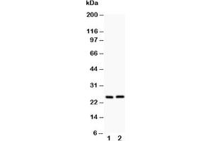 Western blot testing of Claudin 2 antibody and Lane 1:  rat kidney;  2: rat liver
