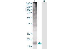 Western Blot analysis of TM4SF4 expression in transfected 293T cell line by TM4SF4 monoclonal antibody (M03), clone 4E6. (TM4SF4 antibody  (AA 1-202))