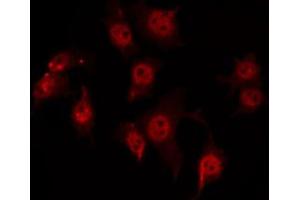 ABIN6274108 staining HuvEc by IF/ICC. (ST18 antibody  (Internal Region))