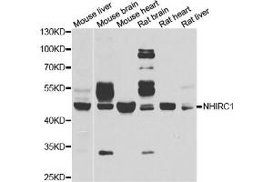 Western blot analysis of extracts of various cell lines, using NHLRC1 antibody. (NHLRC1 antibody)