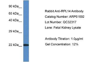 Western Blotting (WB) image for anti-Ribosomal Protein L14 (RPL14) (C-Term) antibody (ABIN786470) (RPL14 antibody  (C-Term))