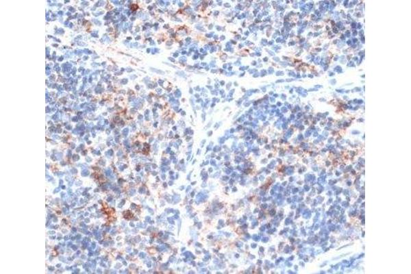 SLAMF7 antibody