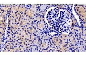 Detection of TSLP in Human Kidney Tissue using Monoclonal Antibody to Thymic Stromal Lymphopoietin (TSLP) (Thymic Stromal Lymphopoietin antibody  (AA 29-159))