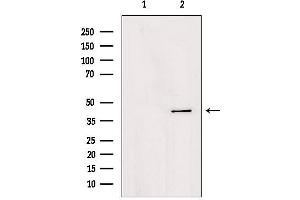 AGPAT4 antibody  (Internal Region)