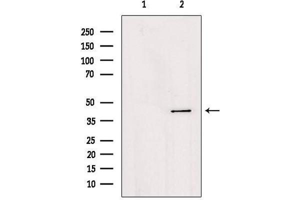 AGPAT4 antibody  (Internal Region)