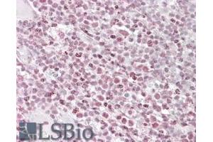 ABIN571070 (3. (IKZF1 antibody  (Internal Region))