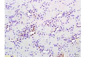 Formalin-fixed and paraffin embedded rat kidney tissue labeled with Anti phospho-MAP3K9+MAP3K10(Thr312+Thr266) Polyclonal Antibody, Unconjugated  at 1:200 followed by conjugation to the secondary antibody and DAB staining (MAP3K9 antibody  (pThr312))