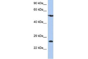 WB Suggested Anti-ZNF10 Antibody Titration:  0.