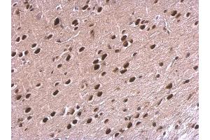 IHC-P Image NPAS1 antibody detects NPAS1 protein at nucleus on rat fore brain by immunohistochemical analysis. (NPAS1 antibody)