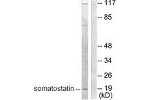 Western blot analysis of extracts from A549 cells, using Somatostatin Antibody. (Somatostatin antibody  (AA 10-59))