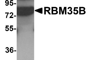 Western blot analysis of RBM35B in human lung tissue lysate with RBM35B antibody at 1 µg/mL.