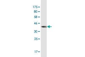 Western Blot detection against Immunogen (36. (FADS3 antibody  (AA 16-113))