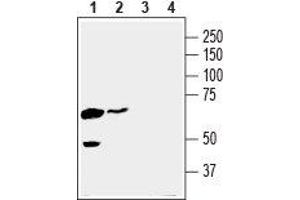 Western blot analysis of human K562 chronic myelogenous leukemia cell line lysate (lanes 1 and 3) and human MDA-MB-231 breast adenocarcinoma cell line lysate (lanes 2 and 4): - 1,2. (SLC16A3 antibody  (C-Term, Intracellular))