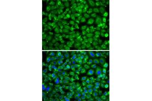 Immunofluorescence analysis of A-549 cells using S antibody . (SAT2 antibody  (AA 1-170))