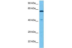 Host:  Rabbit  Target Name:  NR2E1  Sample Tissue:  Human NCI-H226 Whole Cell  Antibody Dilution:  1ug/ml (NR2E1 antibody  (N-Term))