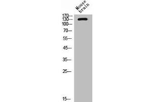 Western Blot analysis of mouse brain cells using CD101 Polyclonal Antibody (CD11 antibody  (Internal Region))