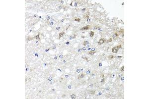 Immunohistochemistry of paraffin-embedded rat brain using METTL20 antibody at dilution of 1:100 (x40 lens). (METTL20 antibody)
