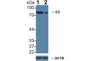 Knockout Varification: Lane 1: Wild-type A431 cell lysate; Lane 2: C2 knockout A431 cell lysate; Predicted MW: 60,69,83kDa Observed MW: 83kDa Primary Ab: 1µg/ml Rabbit Anti-Human C2 Antibody Second Ab: 0. (Complement C2 antibody  (AA 245-451))