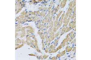 Immunohistochemistry of paraffin-embedded mouse heart using CRHBP antibody (ABIN5973945) at dilution of 1/100 (40x lens). (CRHBP antibody)