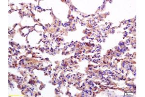 Formalin-fixed and paraffin embedded mouse lung labeled with Anti-MHC Class II/HLA-DPB1 Polyclonal Antibody, Unconjugated (ABIN753928) at 1:200 followed by conjugation to the secondary antibody and DAB staining.