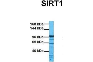 Host:  Rabbit  Target Name:  SIRT1  Sample Tissue:  Human 786-0  Antibody Dilution:  1. (SIRT1 antibody  (N-Term))