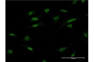 Immunofluorescence of monoclonal antibody to ATF2 on HeLa cell. (ATF2 antibody  (AA 241-340))