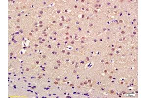 Formalin-fixed and paraffin embedded rat brain labeled with Anti-Thrap3/TRAP150 Polyclonal Antibody, Unconjugated  at 1:200 followed by conjugation to the secondary antibody and DAB staining