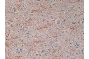 Figure. (Kallikrein 2 antibody  (AA 19-261))