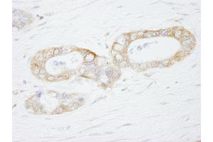 Immunohistochemistry (IHC) image for anti-Ubiquitin Specific Peptidase 3 (USP3) (AA 471-521) antibody (ABIN7449030) (USP3 antibody  (AA 471-521))