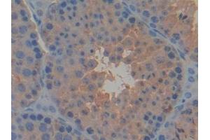 Detection of PDK2 in Mouse Testis Tissue using Polyclonal Antibody to Pyruvate Dehydrogenase Kinase Isozyme 2 (PDK2) (PDK2 antibody  (AA 155-379))