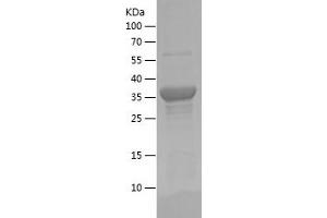 Western Blotting (WB) image for Disabled Homolog 2, Mitogen-Responsive phosphoprotein (Drosophila) (DAB2) (AA 350-450) protein (His-IF2DI Tag) (ABIN7122677) (DAB2 Protein (AA 350-450) (His-IF2DI Tag))