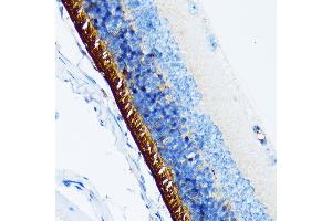 Immunohistochemistry of paraffin-embedded mouse retina using Rhodopsin Rabbit mAb (ABIN7269974) at dilution of 1:100 (40x lens).