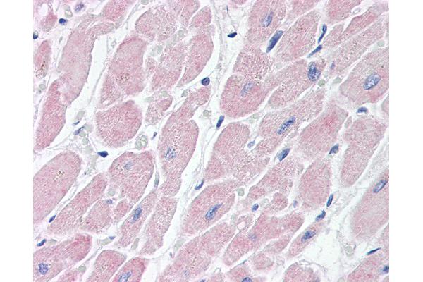 BAI3 antibody  (AA 1506-1522)