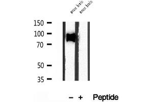 Western blot analysis of extracts of mouse brain tissue, using SEC5/EXOC2 antibody. (EXOC2 antibody  (N-Term))