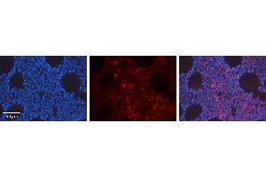 Immunohistochemistry (IHC) image for anti-Hypoxia Inducible Factor 1, alpha Subunit (Basic Helix-Loop-Helix Transcription Factor) (HIF1A) (N-Term) antibody (ABIN2779347)