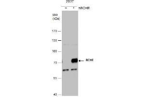 WB Image BCHE antibody detects BCHE protein by western blot analysis. (Butyrylcholinesterase antibody)