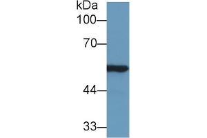 Western Blot; Sample: Rat Kidney lysate; Primary Ab: 1µg/ml Rabbit Anti-Mouse ALDH7A1 Antibody Second Ab: 0. (ALDH7A1 antibody  (AA 29-539))