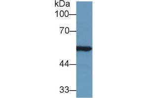 Western Blot; Sample: Rat Kidney lysate; Primary Ab: 1µg/ml Rabbit Anti-Mouse ALDH7A1 Antibody Second Ab: 0. (ALDH7A1 antibody  (AA 29-539))