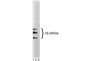 Western blot analysis for basic FGF on a HeLa cell lysate (Human cervical epitheloid carcinoma, ATCC CCL-2). (FGF2 antibody  (AA 1-155))