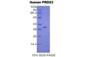 SDS-PAGE (SDS) image for Peroxiredoxin 3 (PRDX3) (AA 5-233) protein (His tag) (ABIN2121838) (Peroxiredoxin 3 Protein (PRDX3) (AA 5-233) (His tag))