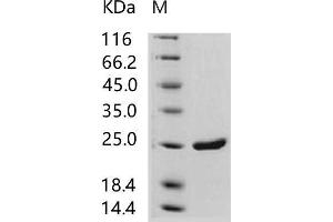 HIV-1 p24 Protein (His tag)