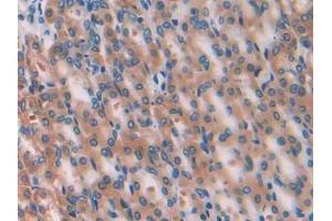 Immunohistochemistry (IHC) image for anti-Glucose-6-Phosphate Isomerase (GPI) (AA 335-558) antibody (ABIN1868229)
