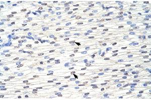 Rabbit Anti-EIF4B Antibody ,Paraffin Embedded Tissue: Human Heart  Cellular Data: Myocardial cells  Antibody Concentration: 4. (EIF4B antibody  (C-Term))